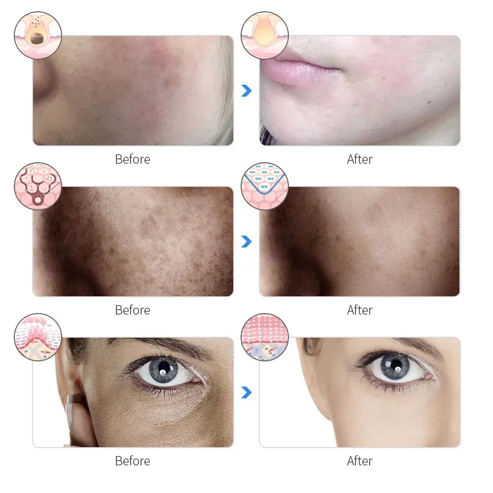 7-Color LED Photon Facial Mask